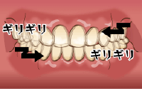 マウスピース 東戸塚の歯医者ocean S Dental Clinic