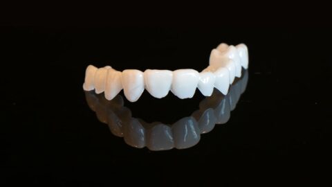 はめるだけで綺麗な白い歯「審美用マウスピース 」｜東戸塚OCEAN 