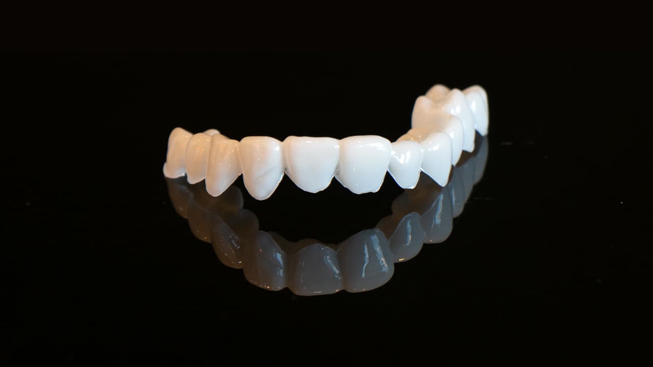 はめるだけで綺麗な白い歯 審美用マウスピース 東戸塚の歯医者 Ocean S Dental Clinic
