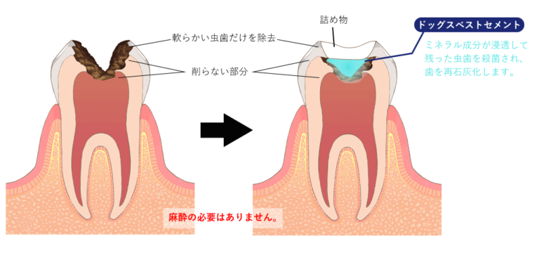 ドッグスベストセメント療法は妊婦さんにもおすすめ