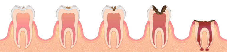 痛くない虫歯治療 東戸塚の歯医者 Ocean S Dental Clinic