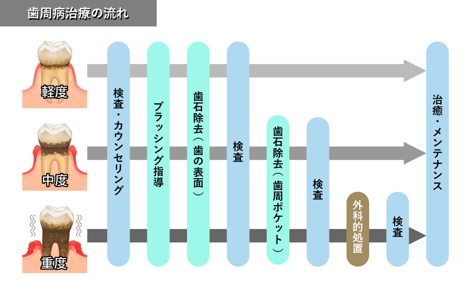 病 歯 治し 方 周