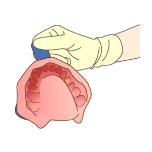 歯型取り-入れ歯製作の流れ